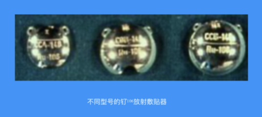 眼部肿瘤有救了!这种新疗法不仅能治肿瘤还保眼球!