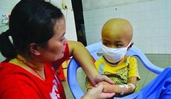 视网膜母细胞瘤的治疗