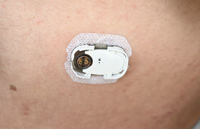 只需一个贴身黑科技小物,让你更有动力管住嘴