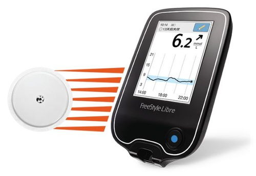 陈根 唾液测血糖,更便携更高效